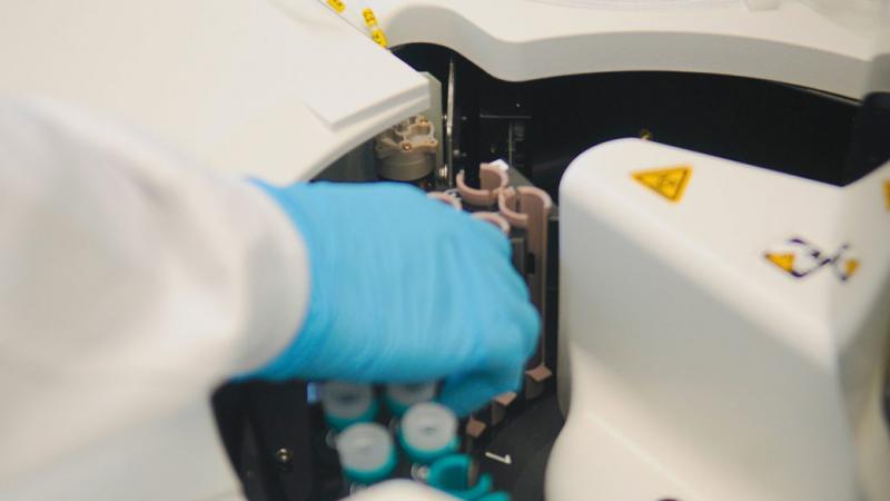 The blood samples are placed into the testing equipment, where they are analyzed to determine whether COVID-19 antibodies are present.